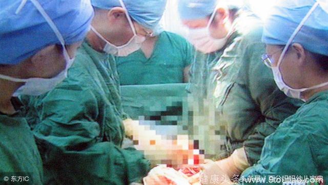23岁孕妈紧急剖腹产，婆婆跪求制止手术，划开肚皮医生被吓懵！