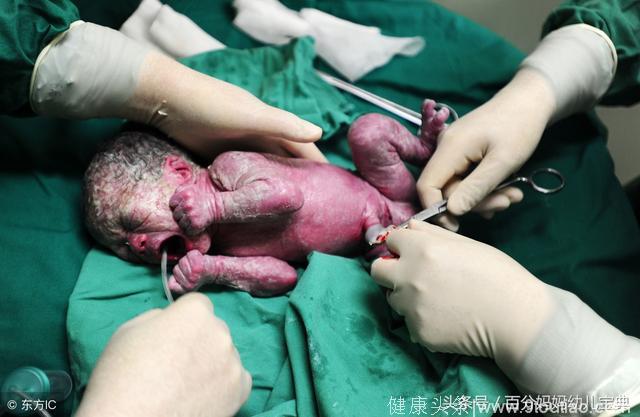 23岁孕妈紧急剖腹产，婆婆跪求制止手术，划开肚皮医生被吓懵！