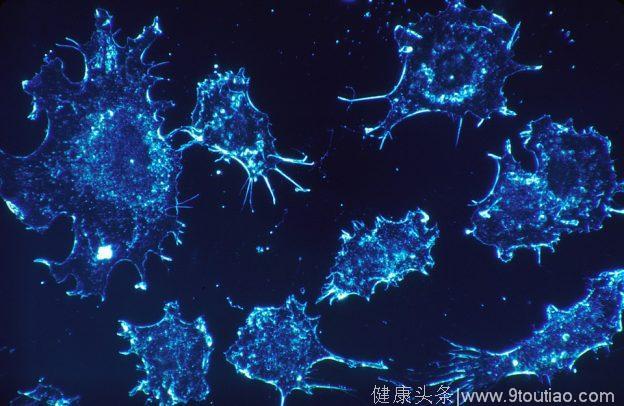美国科学家以全新概念研发抗癌药物，设法“饿”死癌细胞
