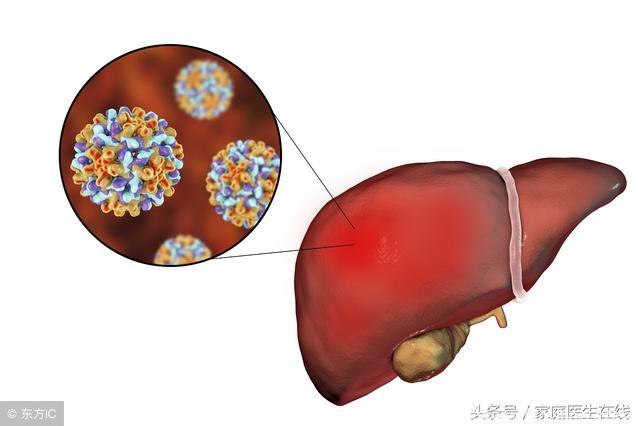 医生透露：体检发现这2种情况，可能离肝癌不远了！