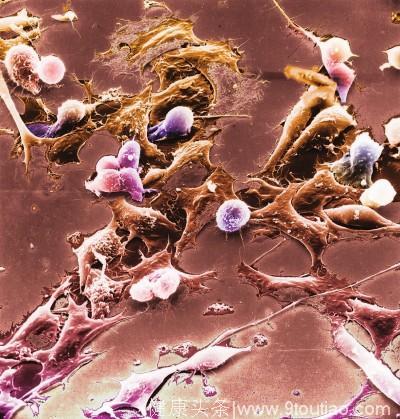 显微镜下的癌细胞竟这么美！听中国医学大家谈肿瘤治疗医术与艺术
