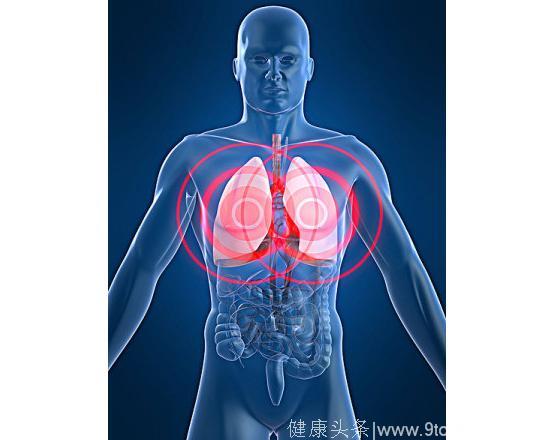 肺癌的六个隐蔽迹象是什么