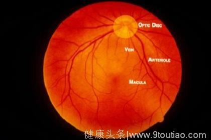 糖尿病患者视力出现问题，不一定都是糖尿病视网膜病变