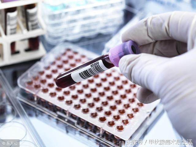 分化型甲状腺癌术后，TSH抑制治疗会导致哪些微甲亢症状？