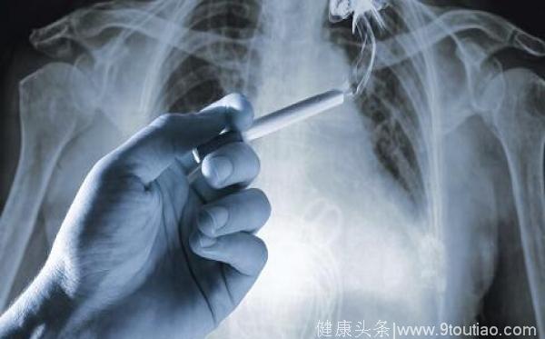 肺癌为什么偏爱中国人？五大方式助攻癌症预防