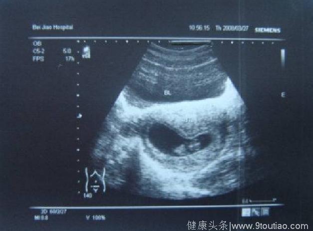 怀孕四个月宝宝b超能看出胎儿的性别吗？
