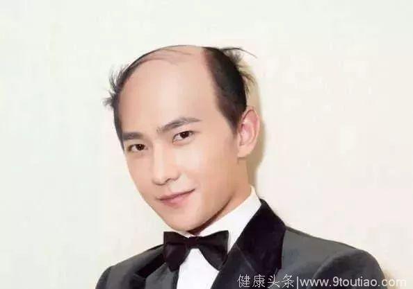“脱发更长寿”上热搜！网友：秃着活那么久有啥意思啊？