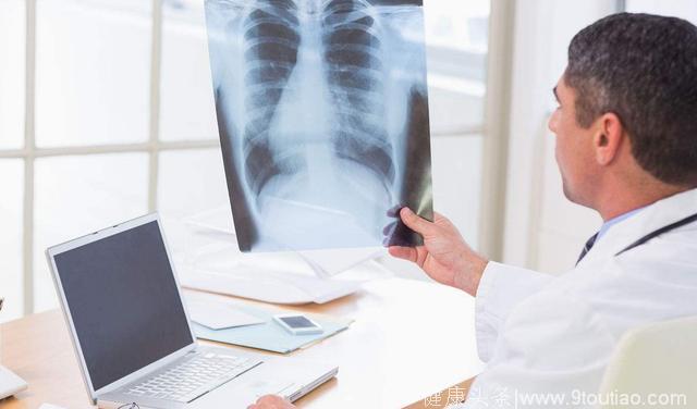 为什么说肺癌是“气”出来的病？记住这五点，让你远离肺癌