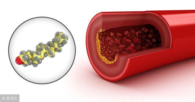 人到中年这四个信号一出现，说明血脂高了，改善血脂多吃2种食物