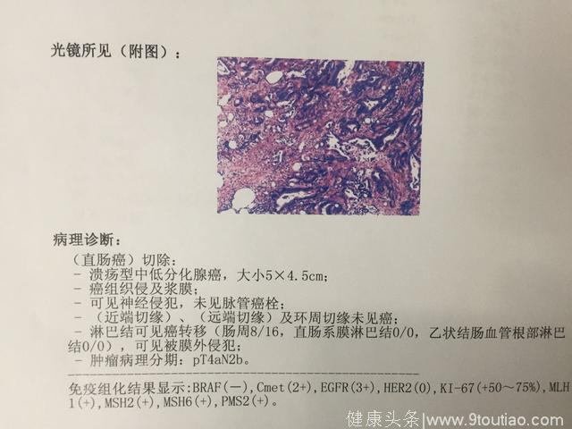 如何理解癌症诊断的金标准---直肠癌术后病理报告解读