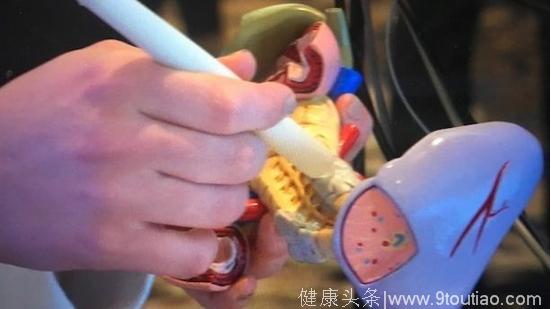 诊断技术获得新突破：20 秒内快速诊断癌症组织