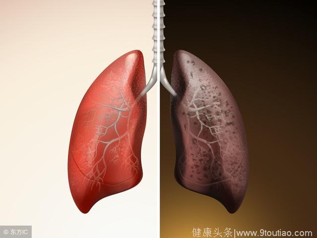 肺癌已位列癌症的第一，肺癌应该做哪些检查