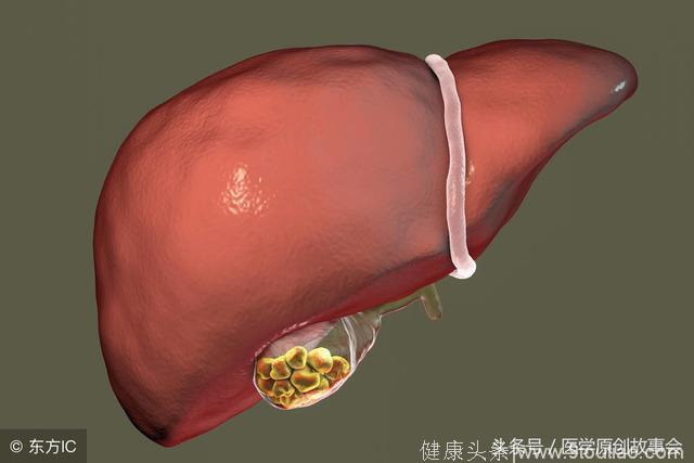 三种坏习惯会损伤肝脏，导致脂肪肝，而你却天天在坚持！