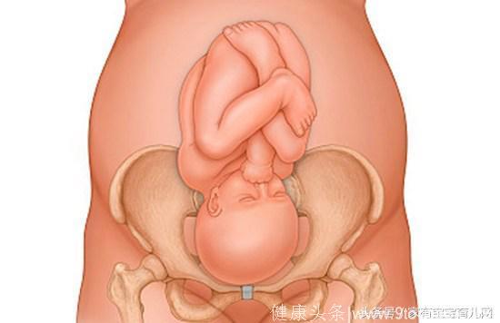 孕晚期胎儿姿势图图片