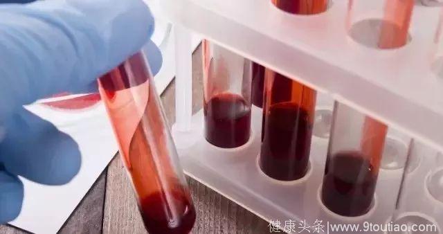 中科院北京基因组所刘欣研究组合作揭示白血病耐药的基因组演化