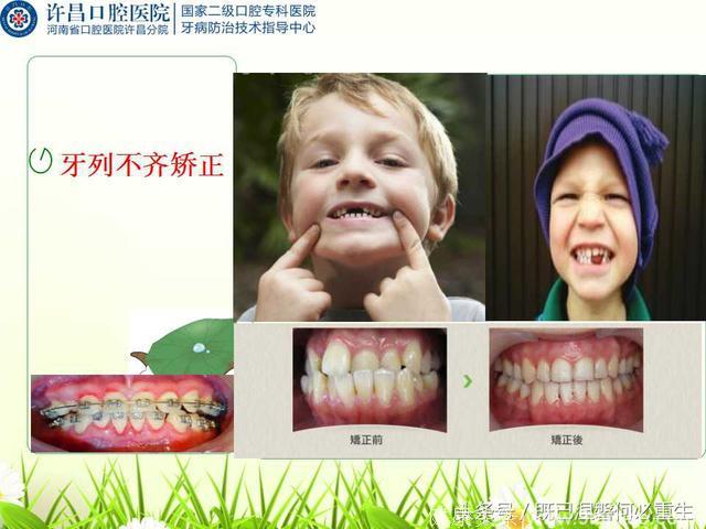 8-10岁儿童常见口腔疾病及预防