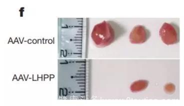 Nature：科学家找到肝癌“抑癌蛋白”，有望带来诊疗新思路