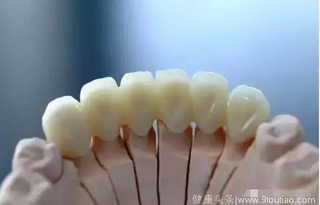 牙医建议您选氧化锆全瓷牙，其实是在为你的长远着想