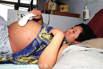 29岁孕妇怀二胎孕肚似双胞胎，送医剖腹手术，却把医生吓出冷汗