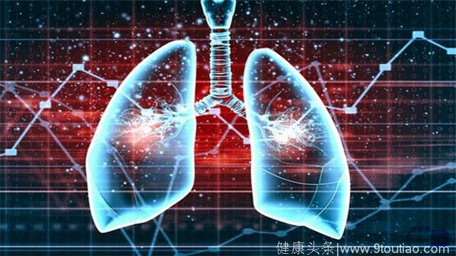 小康每日说：肺癌到了晚期，这些症状最明显！