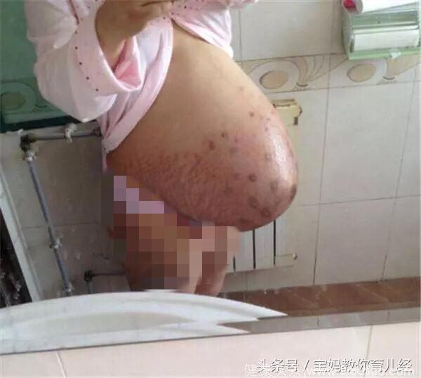 38岁孕妈二胎喜怀多胞胎，可孩子出生后，宝妈却死活不愿出产房！