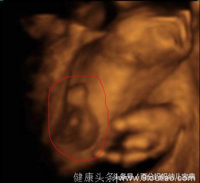 怀孕五个月产检告知胎儿“畸形”，产妇崩溃痛哭，婆婆却乐了！