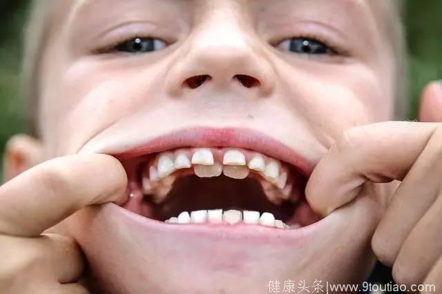 避开八大儿童口腔误区，少让孩子牙疼受罪！