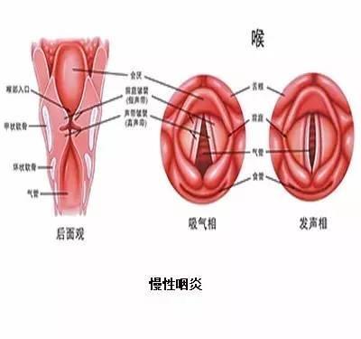 得了鼻炎不重视，鼻炎并发症让你后悔……