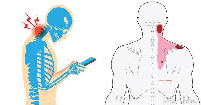 理疗肩颈上背部疼痛，这10个瑜伽动作要经常做