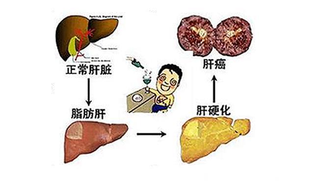 半夜经常“2个”时间醒，身体出现2黑1黄，别迟疑，肝病已经上身