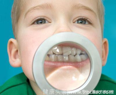 儿童牙齿矫正应比成人更细心！别让儿童小动作阻碍了矫牙的步伐！