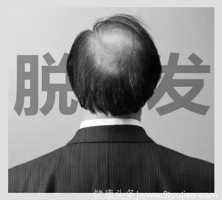 最新研究：“脱发”青睐佛系青年，未来人类可能全员秃顶