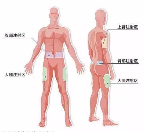 糖尿病打了针血糖还高？一定是这些地方没做好