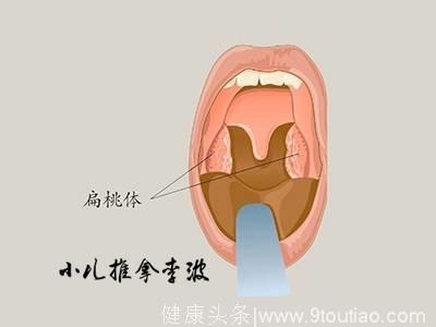 小儿推拿李波老师分享中医小儿推拿治疗孩子扁桃体炎的穴位和手法