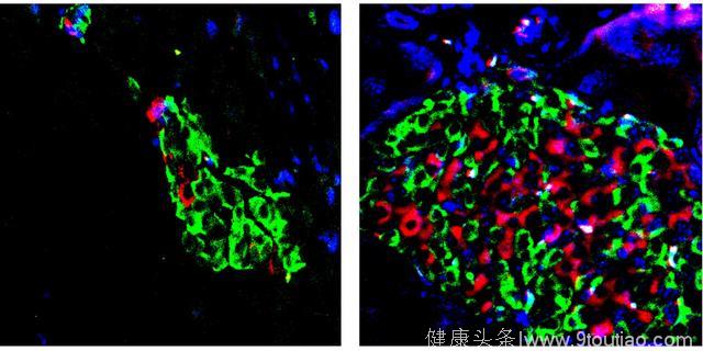 Cell重大发现：用维生素D治疗糖尿病，科学家迈出关键一步！