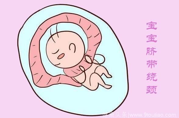 怀孕之后戒掉这个动作，肚子里的胎儿就不会脐带绕颈？
