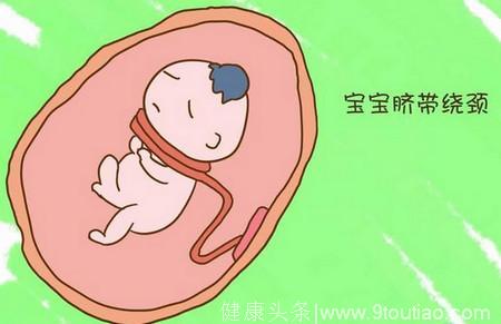 怀孕之后戒掉这个动作，肚子里的胎儿就不会脐带绕颈？