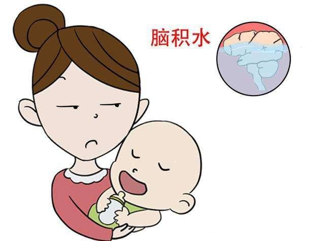 宝宝脑积水怎么办?要如何"排水?