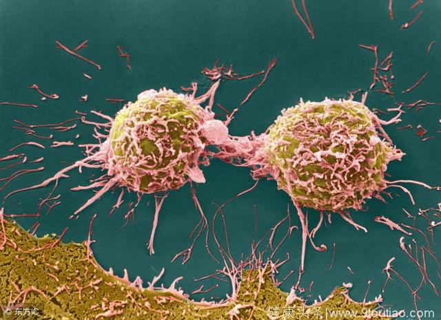 癌症是很多人的噩梦？专家告诉你带瘤生存不是梦！