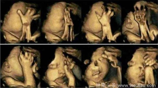 5个月孕妇做四维彩超，宝宝调皮一直动，医生说：这个孩子不能要