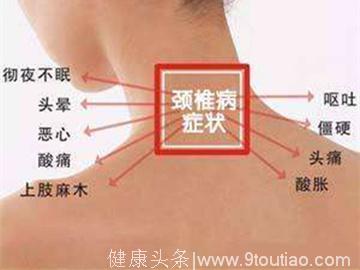 哪些症状预示着颈椎病的发生