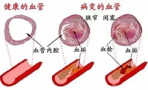 降糖、清血管、补肾气、护肠胃、治失眠……多按这些穴位！