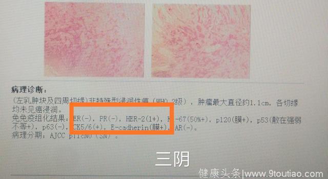 什么是乳腺癌的“三阴、三阳、二阳、一阳”？哪种预后最好？