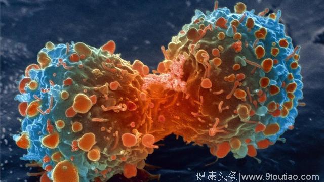 最新研究发现，抗真菌药物伊曲康唑能够有效消灭休眠的癌细胞