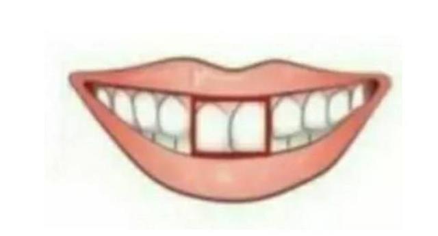 心理测试：你的门牙是下面哪种？一秒测出你今生的财富值！
