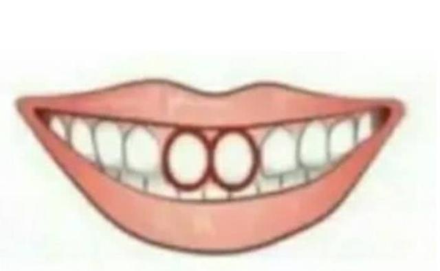 心理测试：你的门牙是下面哪种？一秒测出你今生的财富值！