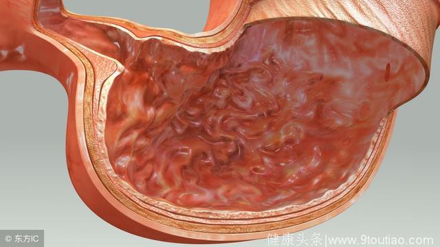 腹泻有助发现4种早期癌症！