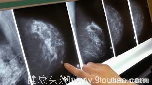 基因测试新研究成果：能助70%早期乳腺癌患者免受化疗之苦