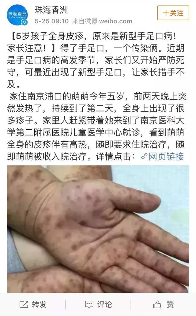 儿科又爆满！新型手足口来了，怎么躲过这一波？