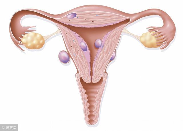 妇科第一瘤有什么症状，通过四步来进行自查